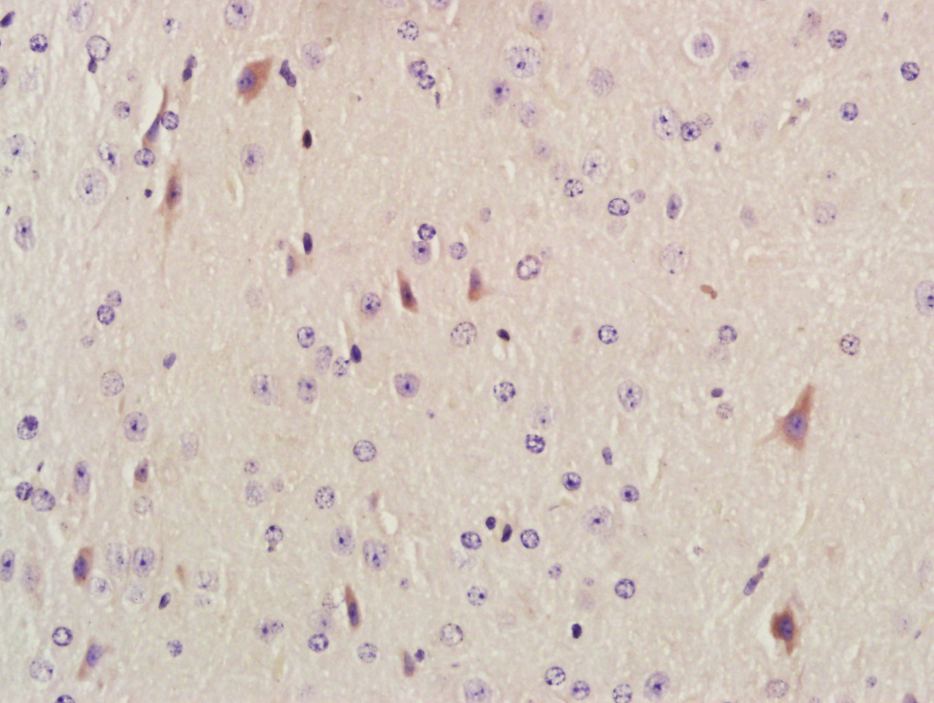 Paraformaldehyde-fixed, paraffin embedded mouse brain; Antigen retrieval by boiling in sodium citrate buffer (pH6.0) for 15min; Block endogenous peroxidase by 3% hydrogen peroxide for 20 minutes; Blocking buffer (normal goat serum) at 37°C for 30min; Antibody incubation with AKAP12 Polyclonal Antibody, Unconjugated (bs-1381R) at 1:400 overnight at 4°C, followed by a conjugated secondary antibody for 20 minutes and DAB staining.