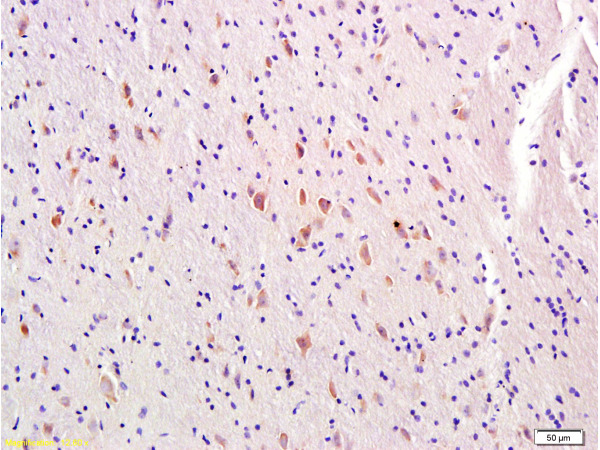 Formalin-fixed and paraffin-embedded rat brain labeled with Rabbit Anti-MTNR1A\/MTR-1A\/MEL-1A-R Polyclonal Antibody, Unconjugated (bs-0027R) at 1:300 followed by conjugation to the secondary antibody