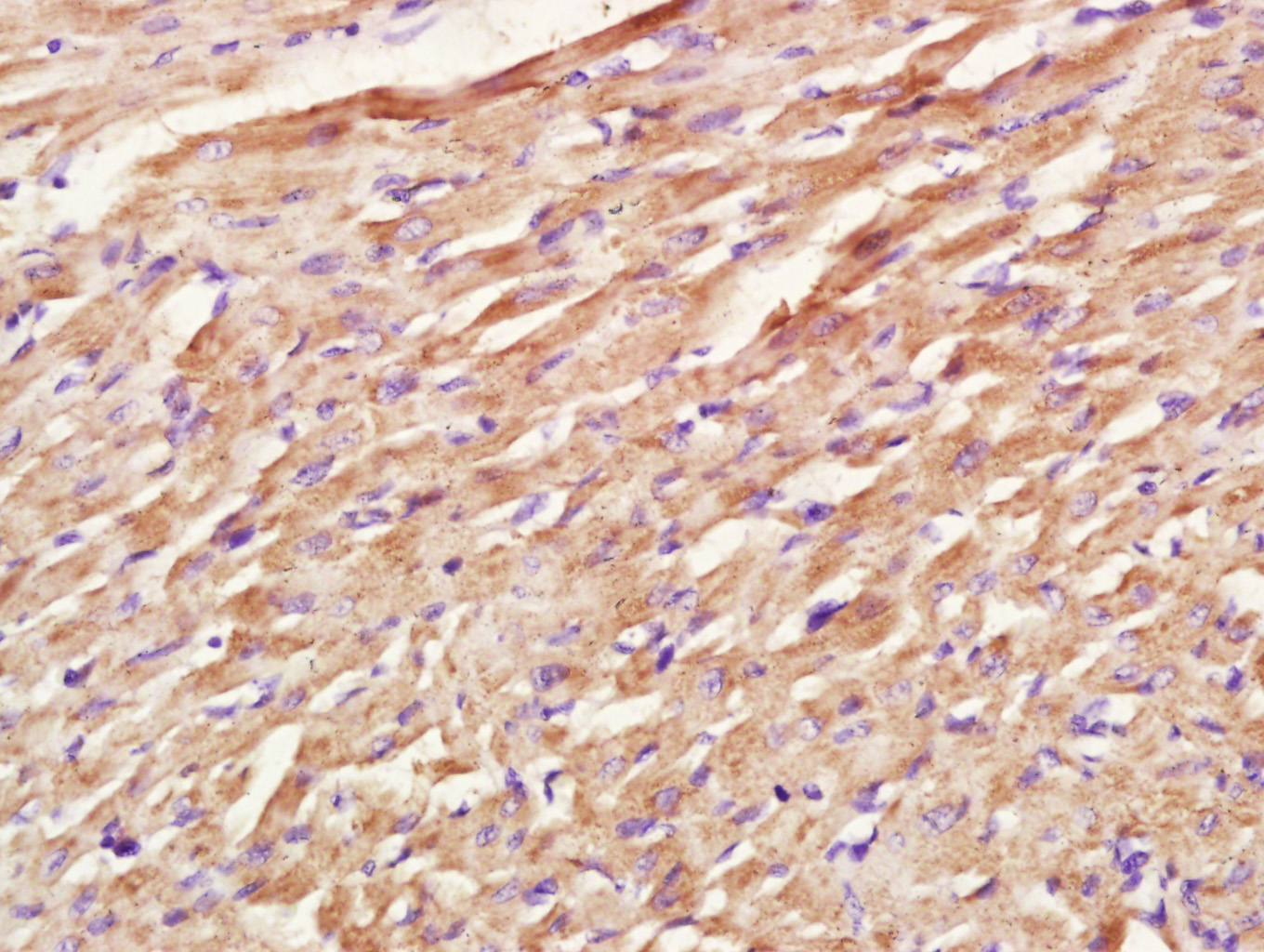 Paraformaldehyde-fixed, paraffin embedded rat heart; Antigen retrieval by boiling in sodium citrate buffer (pH6.0) for 15min; Block endogenous peroxidase by 3% hydrogen peroxide for 20 minutes; Blocking buffer (normal goat serum) at 37°C for 30min; Antibody incubation with COX1/MTCO1 Polyclonal Antibody, Unconjugated (bs-3953R) at 1:400 overnight at 4°C, followed by a conjugated secondary antibody for 20 minutes and DAB staining.