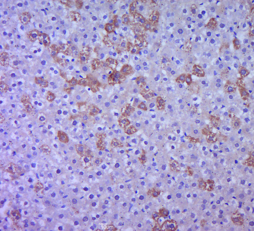 Paraformaldehyde-fixed, paraffin embedded rat liver; Antigen retrieval by boiling in sodium citrate buffer (pH6.0) for 15min; Block endogenous peroxidase by 3% hydrogen peroxide for 20 minutes; Blocking buffer (normal goat serum) at 37°C for 30min; Antibody incubation with P38 MAPK Polyclonal Antibody, Unconjugated (bs-0637R) at 1:400 overnight at 4°C, followed by a conjugated secondary for 20 minutes and DAB staining.