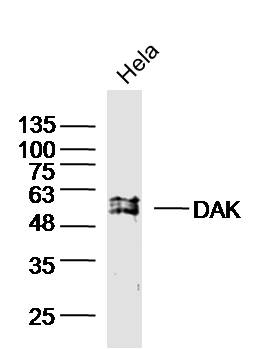 HeLa cell lysates probed with DAK Polyclonal Antibody, unconjugated (bs-20314R) at 1:300 overnight at 4°C followed by a conjugated secondary antibody for 60 minutes at 37°C.
