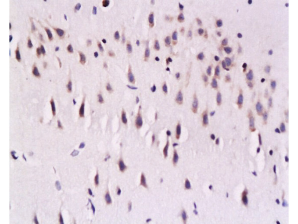 Formalin-fixed and paraffin embedded rat brain labeled with Mouse Anti-Calcineurin A/PP-2B alpha 1 Polyclonal Antibody (bs-0030M), Unconjugated 1:200 followed by conjugation to the secondary antibody and DAB staining