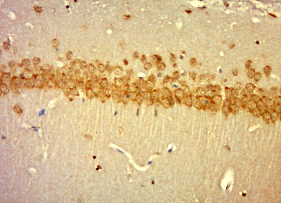 Paraformaldehyde-fixed, paraffin embedded mouse brain tissue; Antigen retrieval by boiling in sodium citrate buffer(pH6) for 15min; Block endogenous peroxidase by 3% hydrogen peroxide for 30 minutes; Blocking buffer (normal goat serum) at 37°C for 20min; Antibody incubation with Rabbit Anti-Laminin Polyclonal Antibody, Unconjugated (bs-0821R) at 1:500 overnight at 4°C, followed by a conjugated secondary and DAB staining