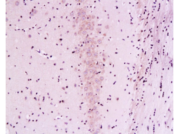 Formalin-fixed and paraffin embedded rat brain labeled with Mouse Anti-Calcineurin A/PP-2B alpha 1 Polyclonal Antibody (bs-0030M), Unconjugated 1:200 followed by conjugation to the secondary antibody and DAB staining