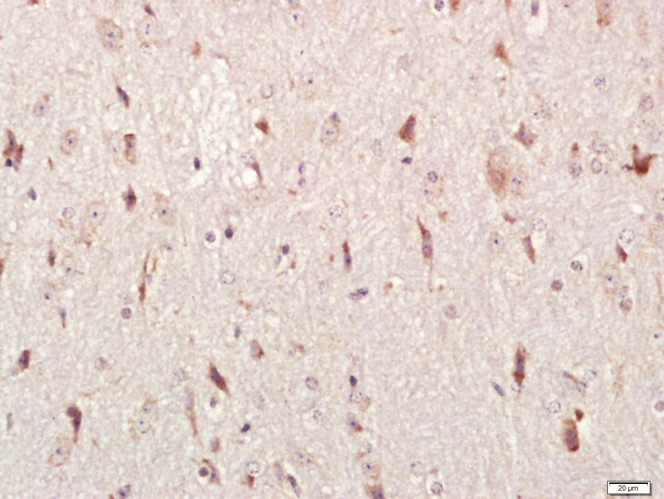 Paraformaldehyde-fixed, paraffin embedded Mouse brain; Antigen retrieval by boiling in sodium citrate buffer (pH6.0) for 15min; Block endogenous peroxidase by 3% hydrogen peroxide for 20 minutes; Blocking buffer (normal goat serum) at 37°C for 30min; Antibody incubation with HEG1 Polyclonal Antibody, Unconjugated (bs-15449R) at 1:400 overnight at 4°C, followed by a conjugated secondary antibody for 20 minutes and DAB staining.