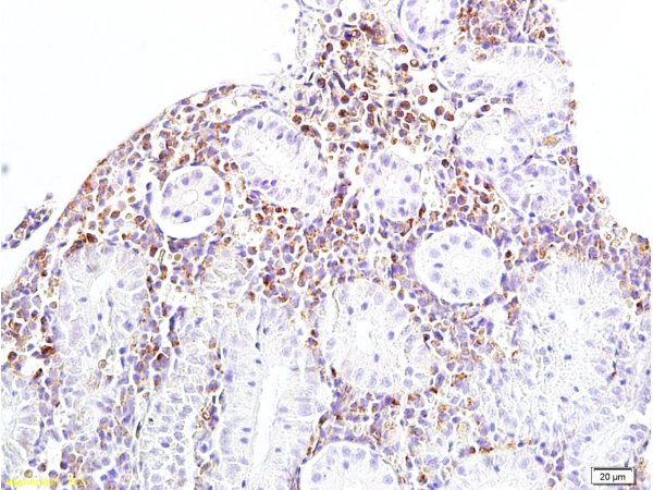 Formalin-fixed and paraffin embedded rat kidney tissue labeled withAnti-Bcl-2 Polyclonal Antibody, Unconjugated (bs-0032r) 1:400 followed by conjugation to the secondary antibody and DAB staining