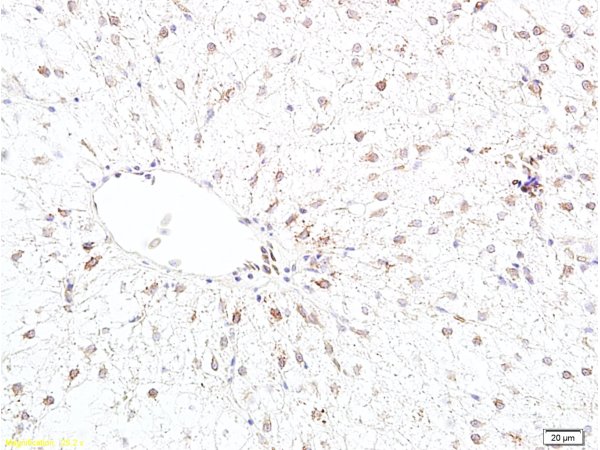 Formalin-fixed and paraffin embedded rat liver tissue labeled with Anti-Bcl-2 Polyclonal Antibody, Unconjugated (bs-0032R) 1:400 followed by conjugation to the secondary antibody and DAB staining