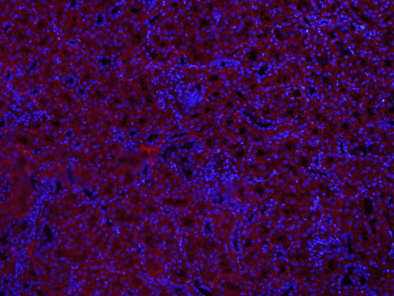 Paraformaldehyde-fixed, paraffin embedded Mouse kidney; Antigen retrieval by boiling in sodium citrate buffer (pH6.0) for 15min; Block endogenous peroxidase by 3% hydrogen peroxide for 20 minutes; Blocking buffer (normal goat serum) at 37°C for 30min; Antibody incubation with MUL1 Polyclonal Antibody, Unconjugated (bs-9291R) at 1:400 overnight at 4°C, followed by a conjugated secondary antibody (bs-0295g-cy3) for 90 minutes, and DAPI for nuclei staining.