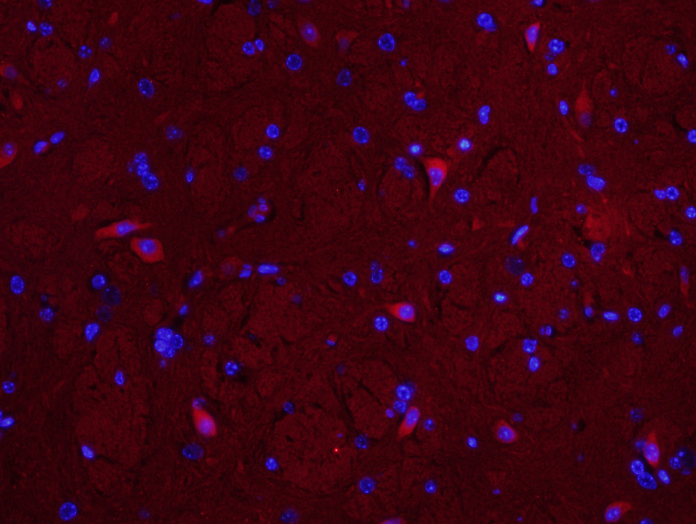 Paraformaldehyde-fixed, paraffin embedded Mouse brain; Antigen retrieval by boiling in sodium citrate buffer (pH6.0) for 15min; Block endogenous peroxidase by 3% hydrogen peroxide for 20 minutes; Blocking buffer (normal goat serum) at 37°C for 30min; Antibody incubation with MUL1 Polyclonal Antibody, Unconjugated (bs-9291R) at 1:400 overnight at 4°C, followed by a conjugated secondary antibody (bs-0295g-cy3) for 90 minutes, and DAPI for nuclei staining.