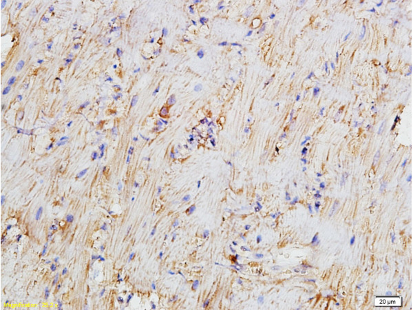 Formalin-fixed and paraffin embedded rat myocardium tissue labeled with Anti-Bcl-2 Polyclonal Antibody, Unconjugated (bs-0032R) 1:300 followed by conjugation to the secondary antibody and DAB staining