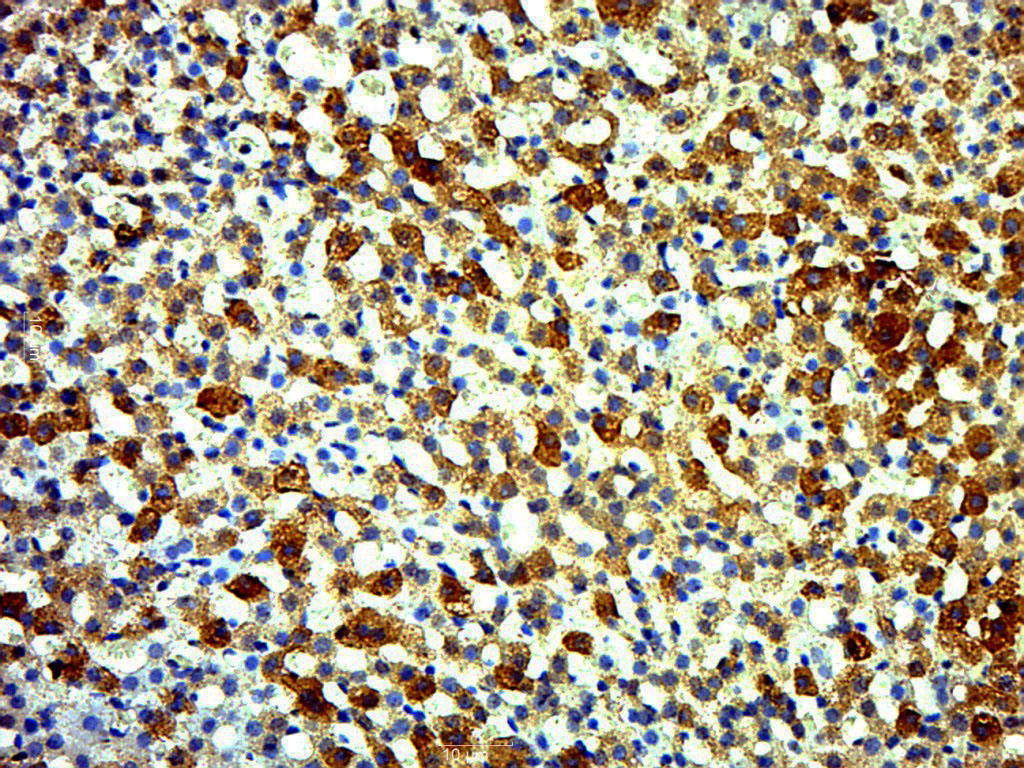 Paraformaldehyde-fixed, paraffin embedded rat adrenal gland; Antigen retrieval by boiling in sodium citrate buffer (pH6.0) for 15min; Block endogenous peroxidase by 3% hydrogen peroxide for 20 minutes; Blocking buffer (normal goat serum) at 37°C for 30min; Antibody incubation with ECRG4 Polyclonal Antibody, Unconjugated (bs-9807R) at 1:500 overnight at 4°C, followed by a conjugated secondary for 20 minutes and DAB staining. _x000D_ _x000D_