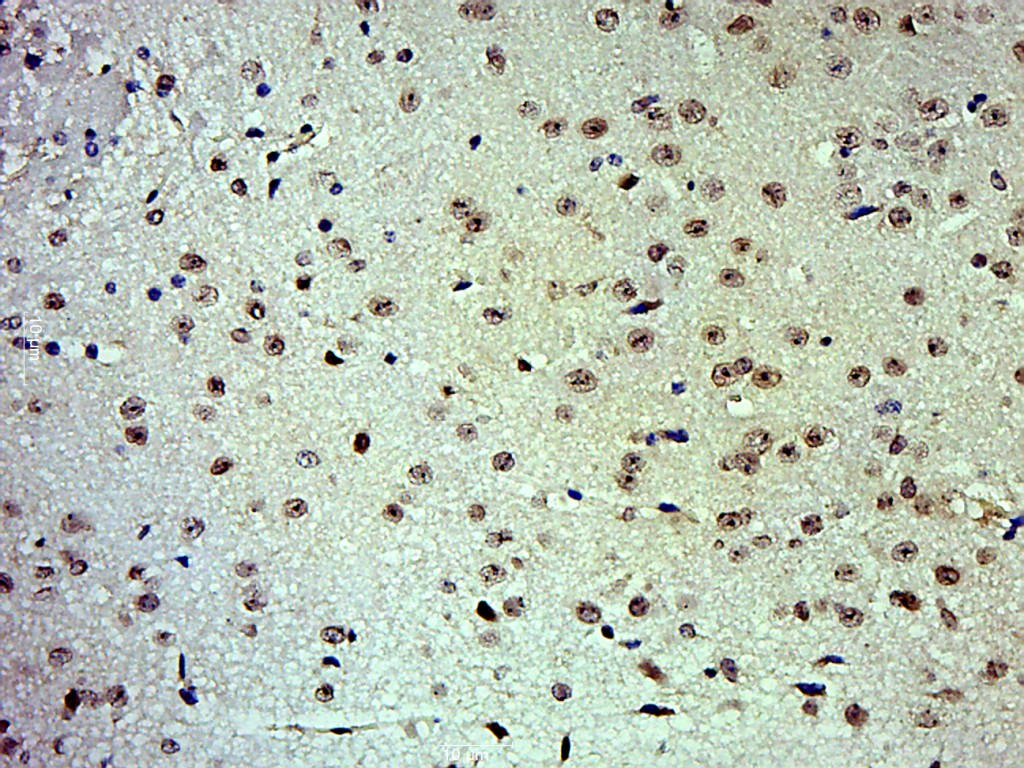 Paraformaldehyde-fixed, paraffin embedded mouse brain; Antigen retrieval by boiling in sodium citrate buffer (pH6.0) for 15min; Block endogenous peroxidase by 3% hydrogen peroxide for 20 minutes; Blocking buffer (normal goat serum) at 37°C for 30min; Antibody incubation with c-jun Polyclonal Antibody, Unconjugated (bs-0670R) at 1:500 overnight at 4°C, followed by a conjugated secondary for 20 minutes and DAB staining.
