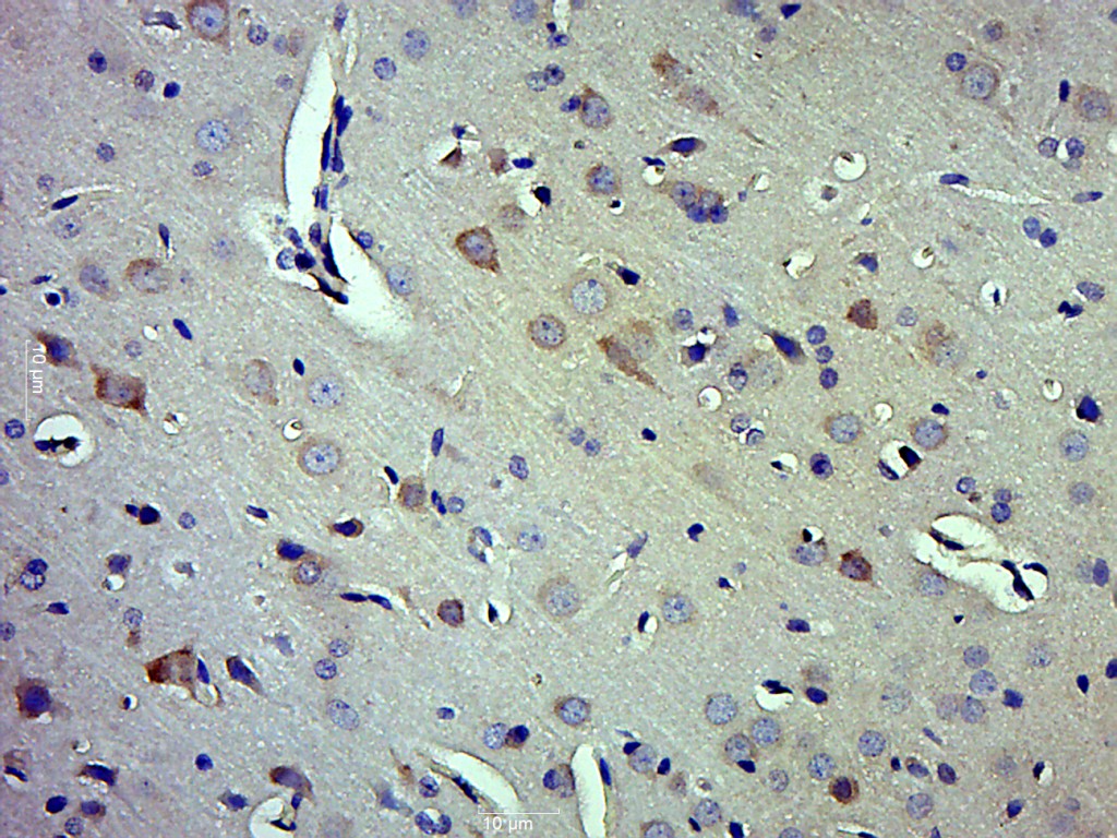 Paraformaldehyde-fixed, paraffin embedded rat brain; Antigen retrieval by boiling in sodium citrate buffer (pH6.0) for 15min; Block endogenous peroxidase by 3% hydrogen peroxide for 20 minutes; Blocking buffer (normal goat serum) at 37°C for 30min; Antibody incubation with Caspase-1 P10 Polyclonal Antibody, Unconjugated (bs-0169R) at 1:500 overnight at 4°C, followed by a conjugated secondary for 20 minutes and DAB staining.