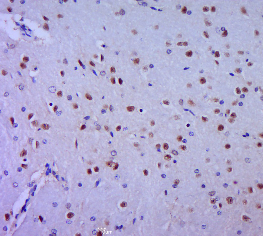 Paraformaldehyde-fixed, paraffin embedded mouse brain; Antigen retrieval by boiling in sodium citrate buffer (pH6.0) for 15min; Block endogenous peroxidase by 3% hydrogen peroxide for 20 minutes; Blocking buffer (normal goat serum) at 37°C for 30min; Antibody incubation with HES1 Polyclonal Antibody, Unconjugated (bs-2972R) at 1:400 overnight at 4°C, followed by a conjugated secondary for 20 minutes and DAB staining.