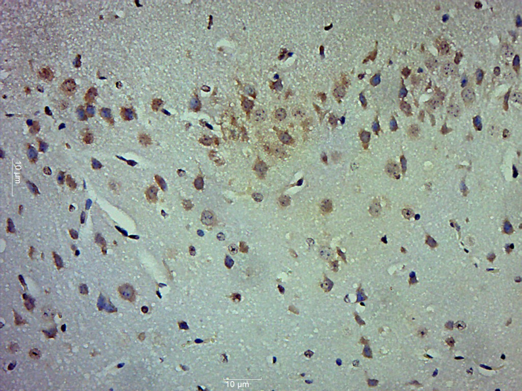 Paraformaldehyde-fixed, paraffin embedded mouse brain; Antigen retrieval by boiling in sodium citrate buffer (pH6.0) for 15min; Block endogenous peroxidase by 3% hydrogen peroxide for 20 minutes; Blocking buffer (normal goat serum) at 37°C for 30min; Antibody incubation with LOX 1 Polyclonal Antibody, Unconjugated (bs-2044R) at 1:500 overnight at 4°C, followed by a conjugated secondary for 20 minutes and DAB staining.