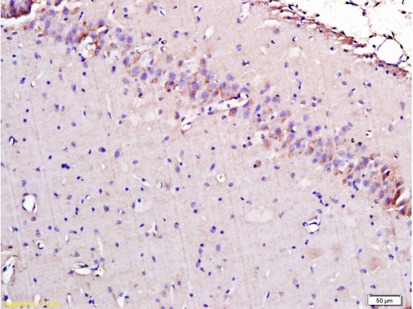 Formalin-fixed and paraffin embedded rat brain labeled with Rabbit Anti-AIF Polyclonal Antibody, Unconjugated (bs-0037R) 1:300 followed by conjugation to the secondary antibody and DAB staining