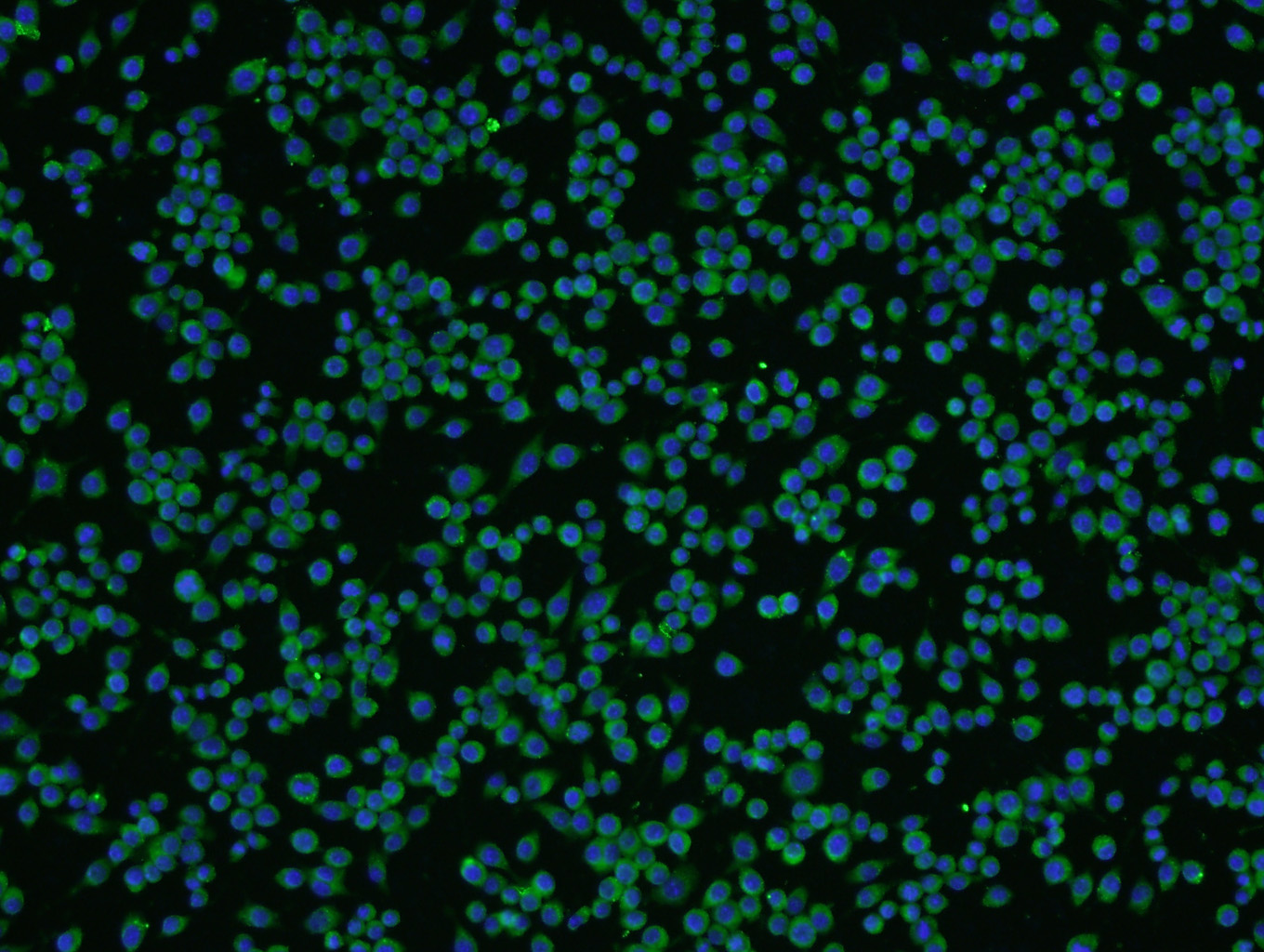 Tissue/cell: BV-2 cell; 4% Paraformaldehyde-fixed; Triton X-100 at room temperature for 20 min; Blocking buffer (normal goat serum) at 37°C for 20 min; Antibody incubation with beta III Tubulin Polyclonal Antibody, Unconjugated (bs-4512R) 1:200, 90 minutes at 37°C; followed by a conjugated secondary antibody (bs-0295G-FITC) at 37°C for 90 minutes, DAPI (5ug/ml) was used to stain the cell nuclei.