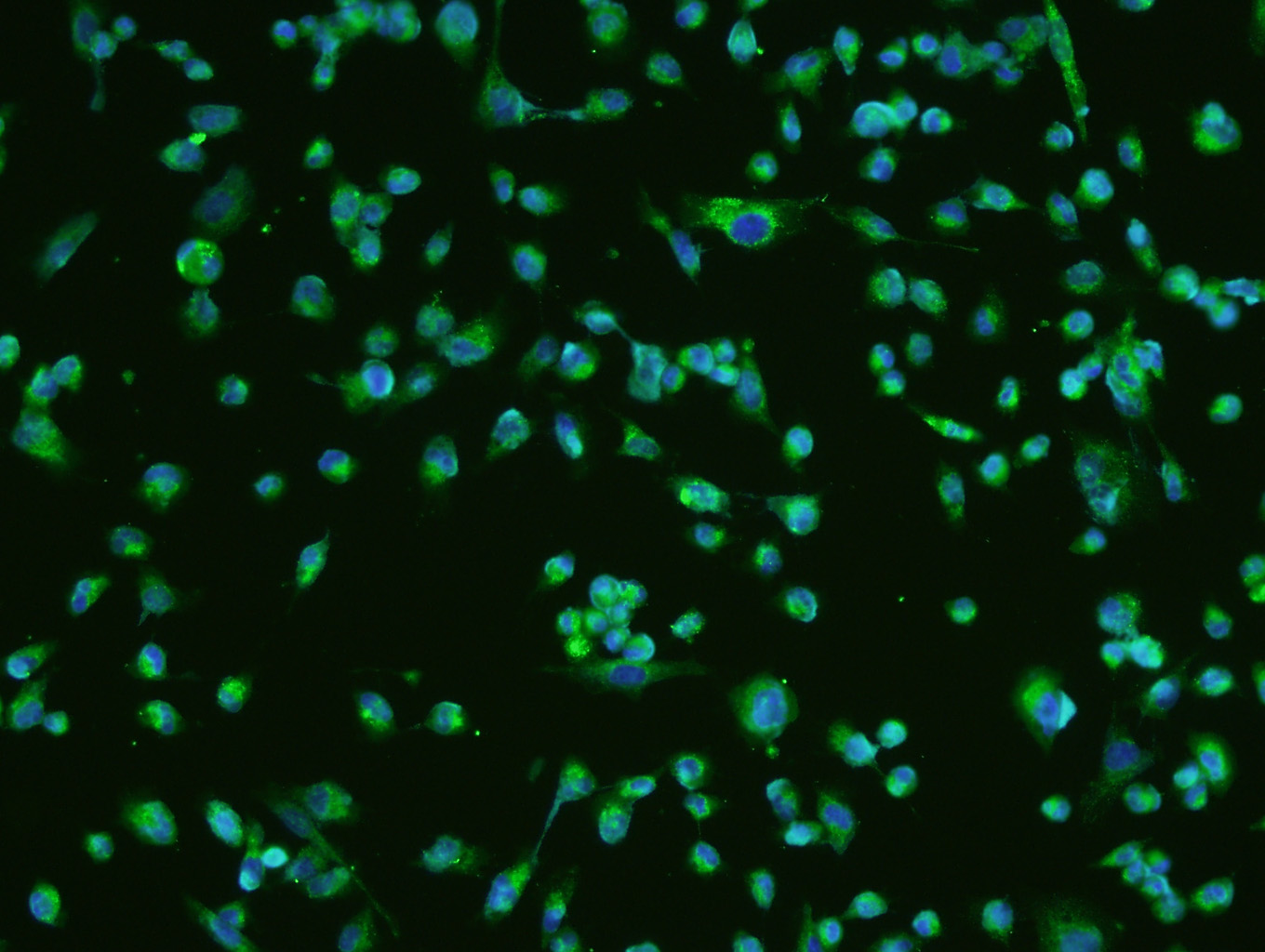 U251 cells; 4% Paraformaldehyde-fixed; Triton X-100 at room temperature for 20 min; Blocking buffer (normal goat serum) at 37C for 20 min; Antibody incubation with BDNF Polyclonal Antibody, Unconjugated (bs-4989R) 1:200, 90 minutes at 37C; followed by a conjugated secondary antibody (bs-0295G-FITC) at 37C for 90 minutes, DAPI (5ug\/ml) was used to stain the cell nuclei.