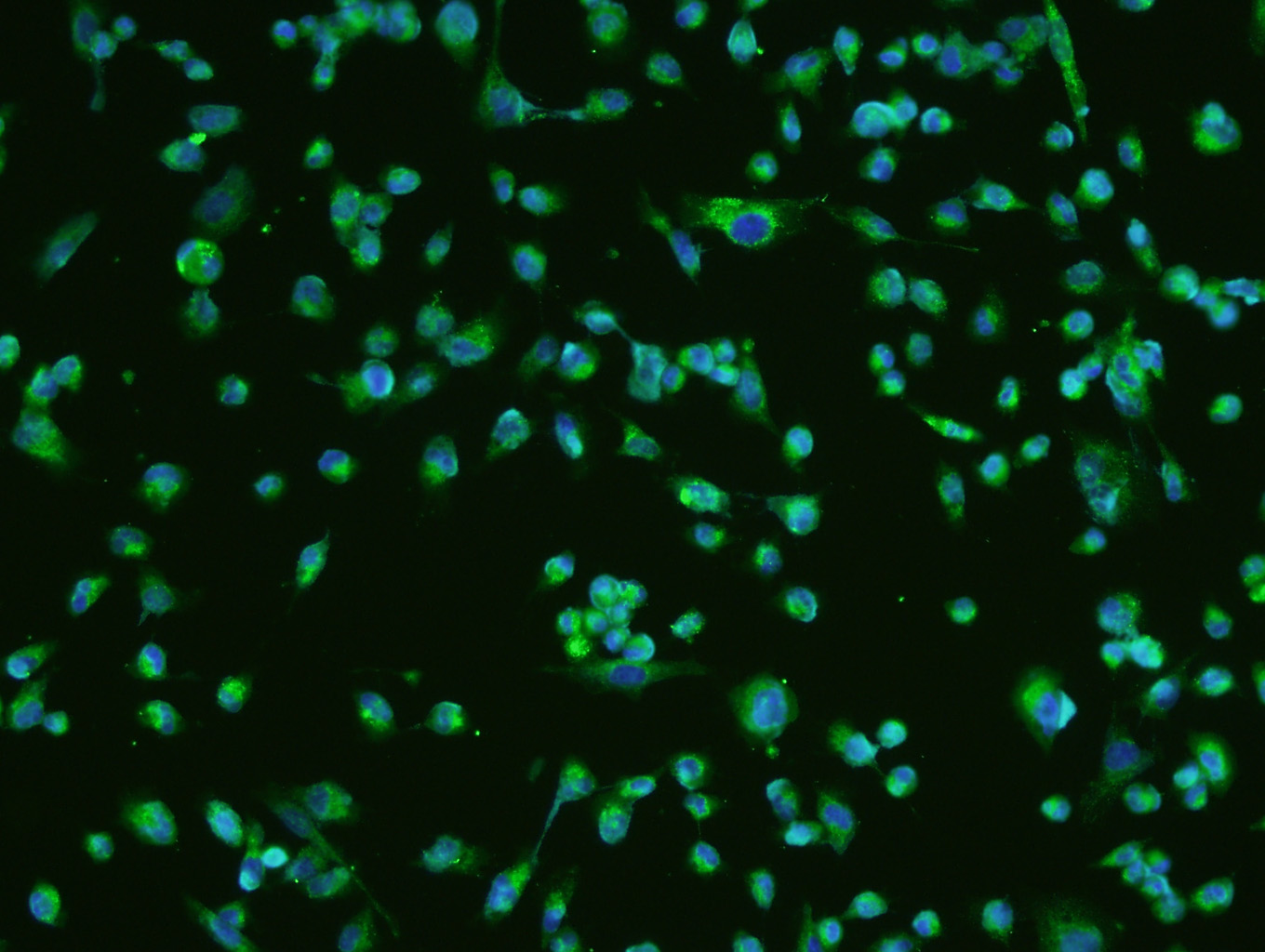 U251 cells; 4% Paraformaldehyde-fixed; Triton X-100 at room temperature for 20 min; Blocking buffer (normal goat serum) at 37C for 20 min; Antibody incubation with BDNF Polyclonal Antibody, Unconjugated (bs-4989R) 1:200, 90 minutes at 37C; followed by a conjugated secondary antibody (bs-0295G-FITC) at 37C for 90 minutes, DAPI (5ug/ml) was used to stain the cell nuclei.