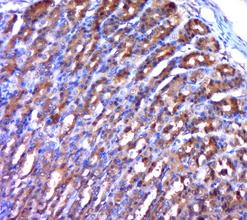 Paraformaldehyde-fixed, paraffin embedded rat stomach; Antigen retrieval by boiling in sodium citrate buffer (pH6.0) for 15min; Block endogenous peroxidase by 3% hydrogen peroxide for 20 minutes; Blocking buffer (normal goat serum) at 37°C for 30min; Antibody incubation with MAP3K8 (Ser400) Polyclonal Antibody, Unconjugated (bs-3454R) at 1:400 overnight at 4°C, followed by a conjugated secondary for 20 minutes and DAB staining.