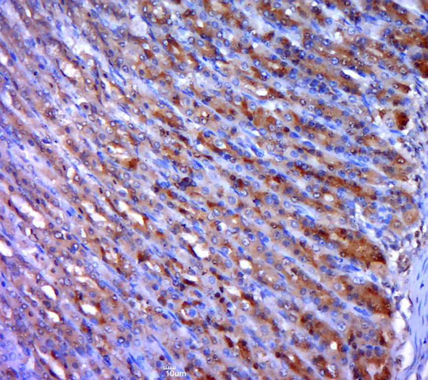 Paraformaldehyde-fixed, paraffin embedded rat stomach; Antigen retrieval by boiling in sodium citrate buffer (pH6.0) for 15min; Block endogenous peroxidase by 3% hydrogen peroxide for 20 minutes; Blocking buffer (normal goat serum) at 37°C for 30min; Antibody incubation with HOXB4 Polyclonal Antibody, Unconjugated (bs-3650R) at 1:400 overnight at 4°C, followed by a conjugated secondary for 20 minutes and DAB staining. Paraformaldehyde-fixed, paraffin embedded rat stomach; Antigen retrieval by boiling in sodium citrate buffer (pH6.0) for 15min; Block endogenous peroxidase by 3% hydrogen peroxide for 20 minutes; Blocking buffer (normal goat serum) at 37°C for 30min; Antibody incubation with HOXB4 Polyclonal Antibody, Unconjugated (bs-3650R) at 1:400 overnight at 4°C, followed by a conjugated secondary for 20 minutes and DAB staining.