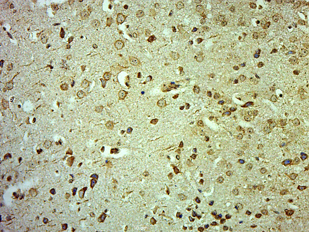 Paraformaldehyde-fixed, paraffin embedded Mouse brain; Antigen retrieval by boiling in sodium citrate buffer (pH6.0) for 15min; Block endogenous peroxidase by 3% hydrogen peroxide for 20 minutes; Blocking buffer (normal goat serum) at 37°C for 30min; Antibody incubation with CLCN3 Polyclonal Antibody, Unconjugated (bs-6981R) at 1:500 overnight at 4°C, followed by a conjugated secondary for 20 minutes and DAB staining.