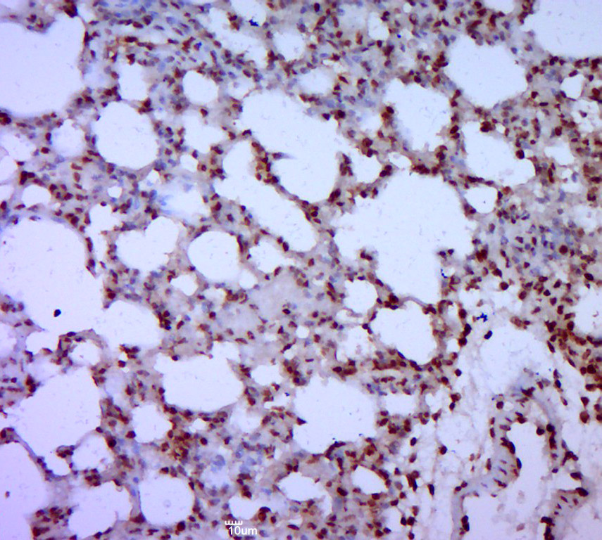 Paraformaldehyde-fixed, paraffin embedded rat lung; Antigen retrieval by boiling in sodium citrate buffer (pH6.0) for 15min; Block endogenous peroxidase by 3% hydrogen peroxide for 20 minutes; Blocking buffer (normal goat serum) at 37°C for 30min; Antibody incubation with GATA5 Polyclonal Antibody, Unconjugated (bs-1779R) at 1:400 overnight at 4°C, followed by a conjugated secondary for 20 minutes and DAB staining.