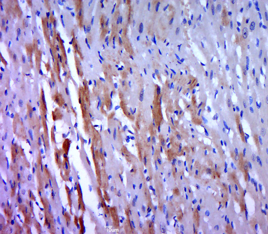 Paraformaldehyde-fixed, paraffin embedded rat heart; Antigen retrieval by boiling in sodium citrate buffer (pH6.0) for 15min; Block endogenous peroxidase by 3% hydrogen peroxide for 20 minutes; Blocking buffer (normal goat serum) at 37°C for 30min; Antibody incubation with MEK7 (Ser271 + Thr275) Polyclonal Antibody, Unconjugated (bs-3277R) at 1:400 overnight at 4°C, followed by a conjugated secondary (sp-0023) for 20 minutes and DAB staining.