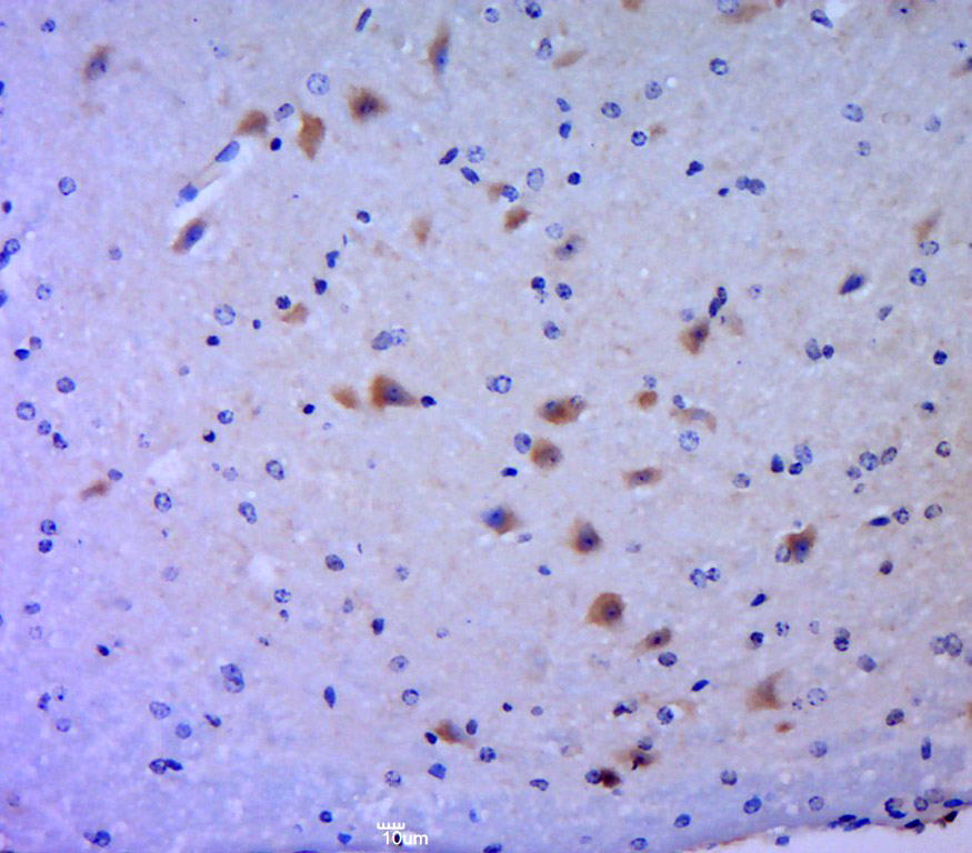 Paraformaldehyde-fixed, paraffin embedded mouse brain; Antigen retrieval by boiling in sodium citrate buffer (pH6.0) for 15min; Block endogenous peroxidase by 3% hydrogen peroxide for 20 minutes; Blocking buffer (normal goat serum) at 37°C for 30min; Antibody incubation with MLK3(Thr277 + Ser281) Antibody, Unconjugated (bs-3280R) at 1:400 overnight at 4°C, followed by a conjugated secondary for 20 minutes and DAB staining.