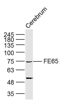 Lane 1: Mouse cerebrum lysates probed with FE65 Polyclonal Antibody, Unconjugated (bs-0110R) at 1:300 overnight at 4˚C. Followed by a conjugated secondary antibody at 1:20000 for 90 min at 37˚C.