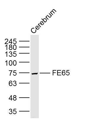Lane 1: Rat cerebrum lysates probed with FE65 Polyclonal Antibody, Unconjugated (bs-0110R) at 1:300 overnight at 4˚C. Followed by a conjugated secondary antibody at 1:20000 for 90 min at 37˚C.