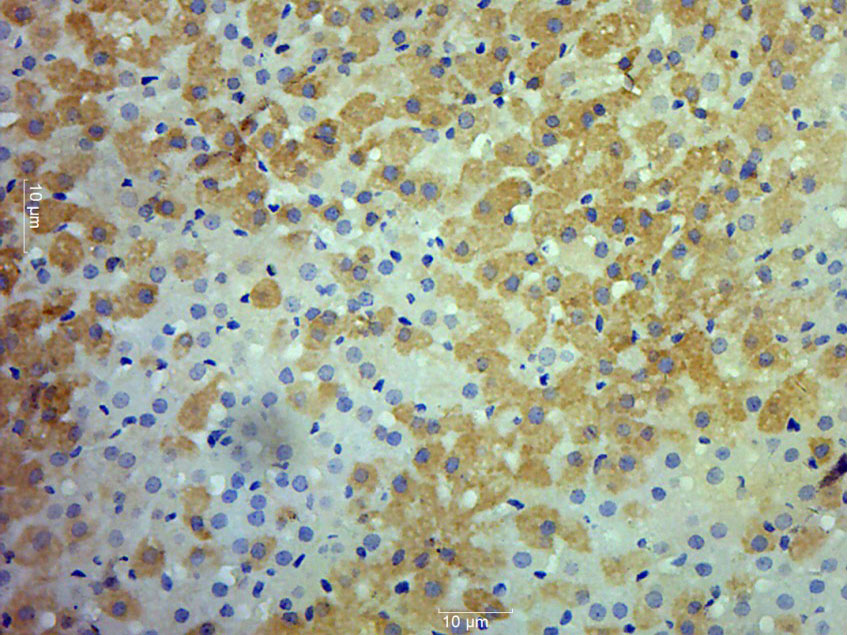 Paraformaldehyde-fixed, paraffin embedded rat adrenal gland; Antigen retrieval by boiling in sodium citrate buffer (pH6.0) for 15min; Block endogenous peroxidase by 3% hydrogen peroxide for 20 minutes; Blocking buffer (normal goat serum) at 37°C for 30min; Antibody incubation with RET Polyclonal Antibody, Unconjugated (bs-2793R) at 1:500 overnight at 4°C, followed by a conjugated secondary for 20 minutes and DAB staining.