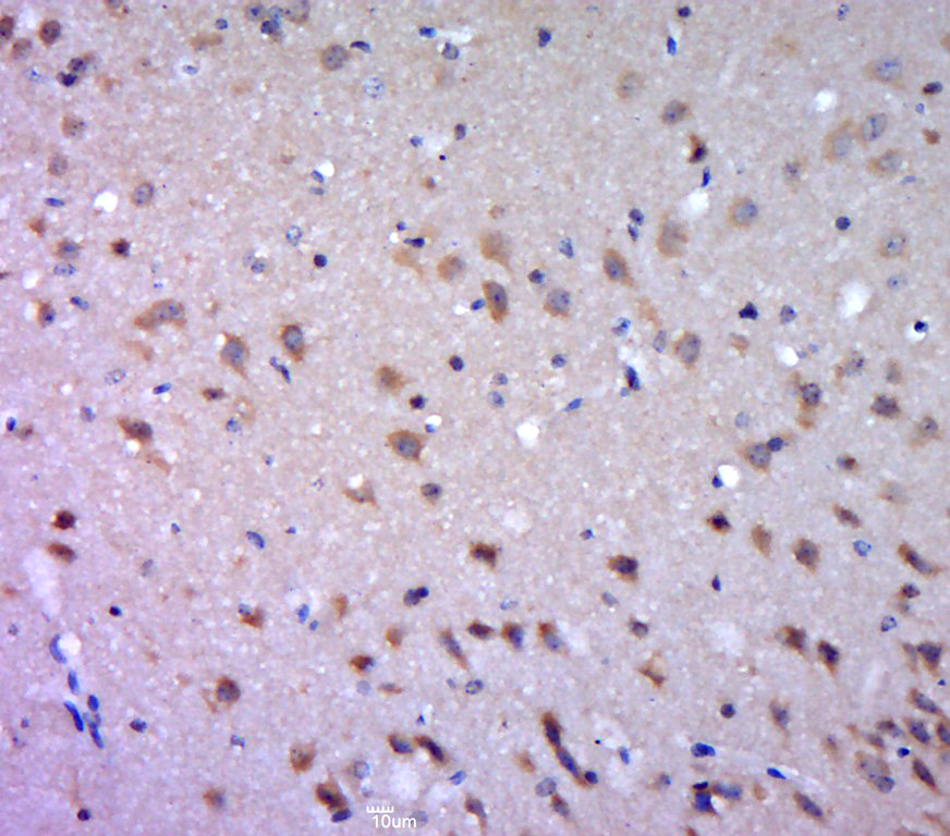 Paraformaldehyde-fixed, paraffin embedded mouse brain; Antigen retrieval by boiling in sodium citrate buffer (pH6.0) for 15min; Block endogenous peroxidase by 3% hydrogen peroxide for 20 minutes; Blocking buffer (normal goat serum) at 37°C for 30min; Antibody incubation with DGAT1 Polyclonal Antibody, Unconjugated (bs-2332R) at 1:400 overnight at 4°C, followed by a conjugated secondary for 20 minutes and DAB staining.