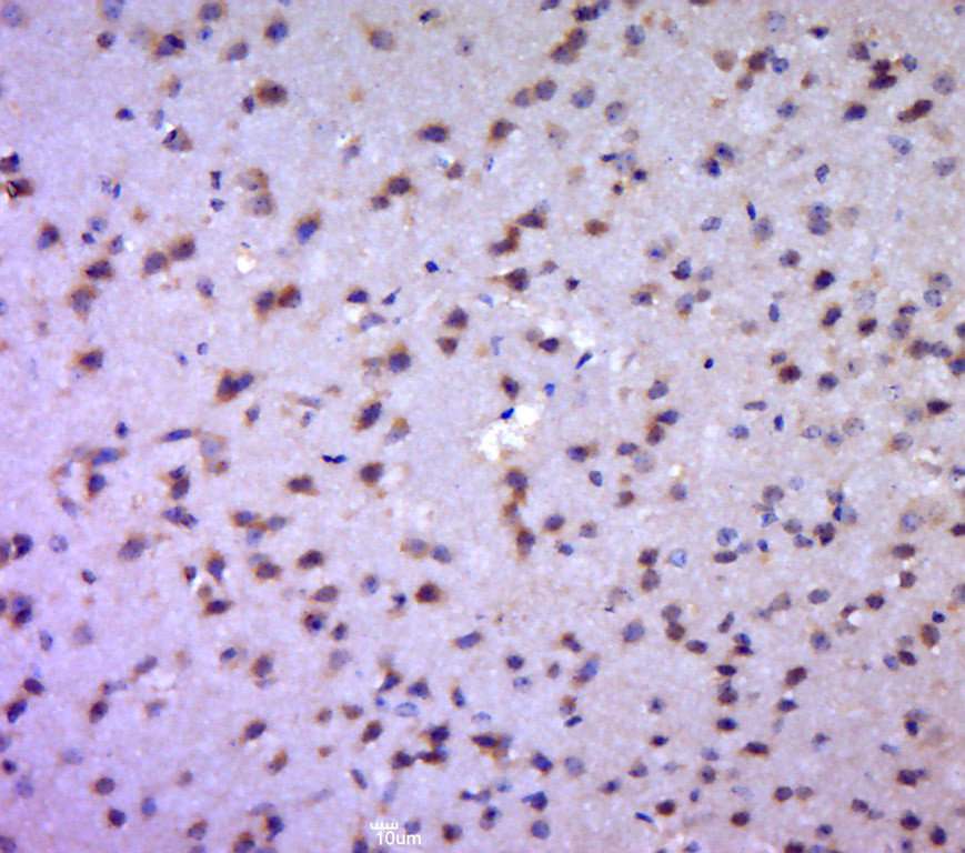 Paraformaldehyde-fixed, paraffin embedded mouse brain; Antigen retrieval by boiling in sodium citrate buffer (pH6.0) for 15min; Block endogenous peroxidase by 3% hydrogen peroxide for 20 minutes; Blocking buffer (normal goat serum) at 37°C for 30min; Antibody incubation with Aldolase Polyclonal Antibody, Unconjugated (bs-2406R) at 1:400 overnight at 4°C, followed by a conjugated secondary for 20 minutes and DAB staining.