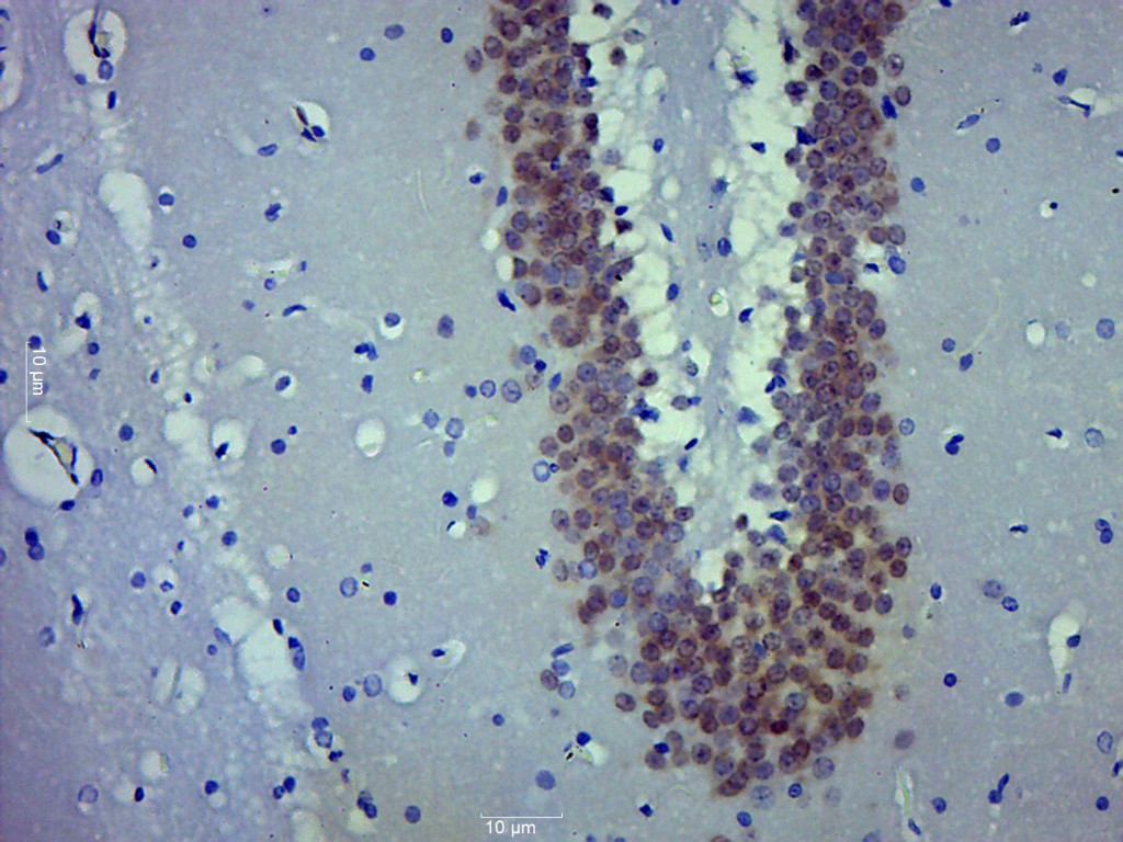 Paraformaldehyde-fixed, paraffin embedded rat brain; Antigen retrieval by boiling in sodium citrate buffer (pH6.0) for 15min; Block endogenous peroxidase by 3% hydrogen peroxide for 20 minutes; Blocking buffer (normal goat serum) at 37°C for 30min; Antibody incubation with FOX3/NeuN Polyclonal Antibody, Unconjugated (bs-1613R) at 1:500 overnight at 4°C, followed by a conjugated secondary for 20 minutes and DAB staining.