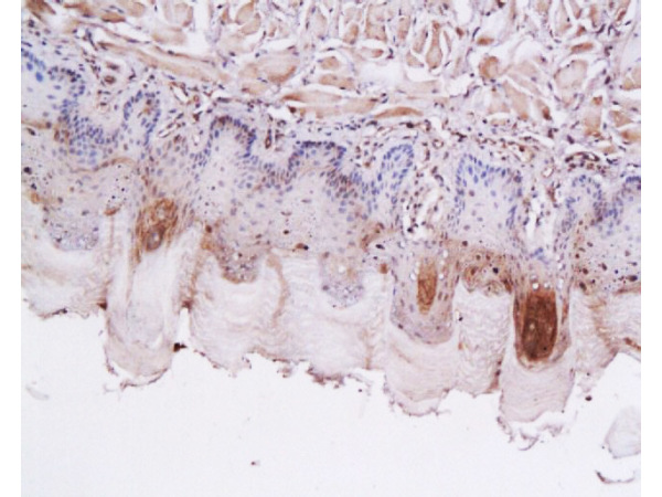 Formalin-fixed and paraffin embedded rat tongue labeled with Anti-GLP-1 (7-36) Polyclonal Antibody, Unconjugated(bs-0038R) 1:200 followed by conjugation to the secondary antibody and DAB staining