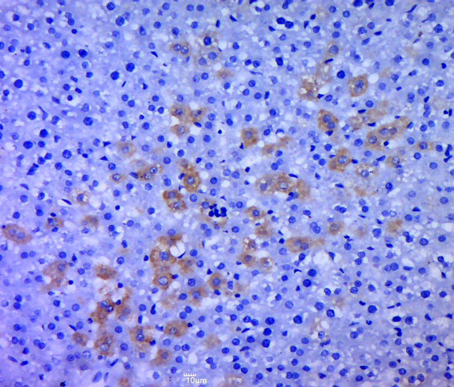 Paraformaldehyde-fixed, paraffin embedded rat liver; Antigen retrieval by boiling in sodium citrate buffer (pH6.0) for 15min; Block endogenous peroxidase by 3% hydrogen peroxide for 20 minutes; Blocking buffer (normal goat serum) at 37°C for 30min; Antibody incubation with RPS6KB1 Polyclonal Antibody, Unconjugated (bs-1426R) at 1:400 overnight at 4°C, followed by a conjugated secondary for 20 minutes and DAB staining.