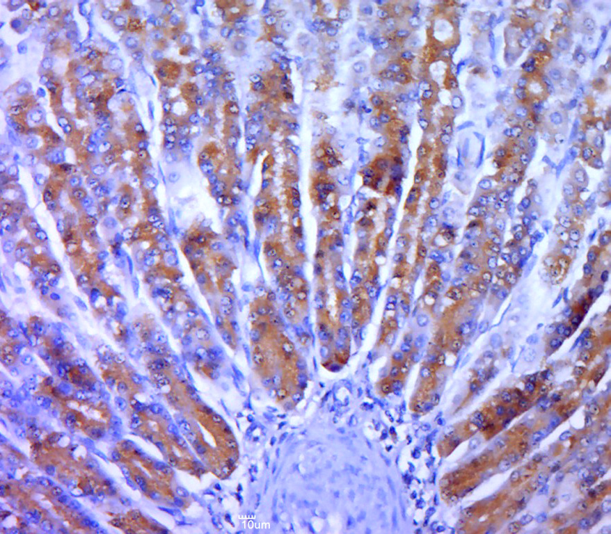 Paraformaldehyde-fixed, paraffin embedded rat stomach; Antigen retrieval by boiling in sodium citrate buffer (pH6.0) for 15min; Block endogenous peroxidase by 3% hydrogen peroxide for 20 minutes; Blocking buffer (normal goat serum) at 37°C for 30min; Antibody incubation with MAPKAP Kinase 2 Polyclonal Antibody, Unconjugated (bs-2908R) at 1:400 overnight at 4°C, followed by a conjugated secondary for 20 minutes and DAB staining.