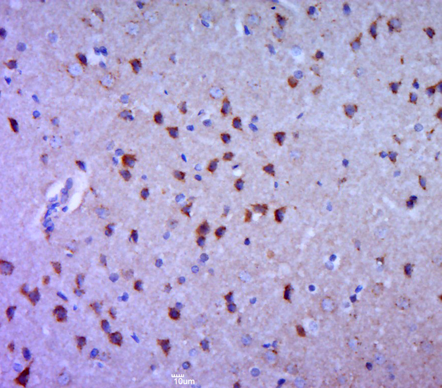 Paraformaldehyde-fixed, paraffin embedded rat brain; Antigen retrieval by boiling in sodium citrate buffer (pH6.0) for 15min; Block endogenous peroxidase by 3% hydrogen peroxide for 20 minutes; Blocking buffer (normal goat serum) at 37°C for 30min; Antibody incubation with 5HT4 Receptor Polyclonal Antibody, Unconjugated (bs-2127R) at 1:400 overnight at 4°C, followed by a conjugated secondary for 20 minutes and DAB staining.