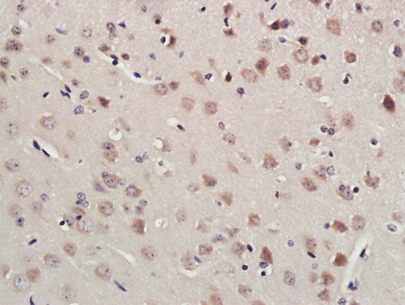 Paraformaldehyde-fixed, paraffin embedded Mouse brain; Antigen retrieval by boiling in sodium citrate buffer (pH6.0) for 15min; Block endogenous peroxidase by 3% hydrogen peroxide for 20 minutes; Blocking buffer (normal goat serum) at 37°C for 30min; Antibody incubation with RNF213 Polyclonal Antibody, Unconjugated (bs-9840R) at 1:400 overnight at 4°C, followed by a conjugated secondary antibody for 20 minutes and DAB staining.