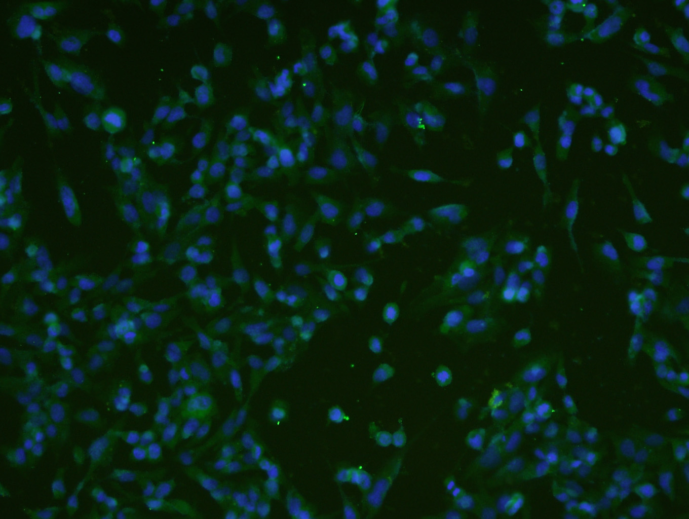 U251 cells were stained with ATF6 Polyclonal Antibody (bs-1634R) at 1:200 in PBS and incubated for two hours at 37°C followed by Goat Anti-Rabbit IgG (H+L) FITC conjugated secondary antibody. DAPI staining of the nucleus was done and then detected.
