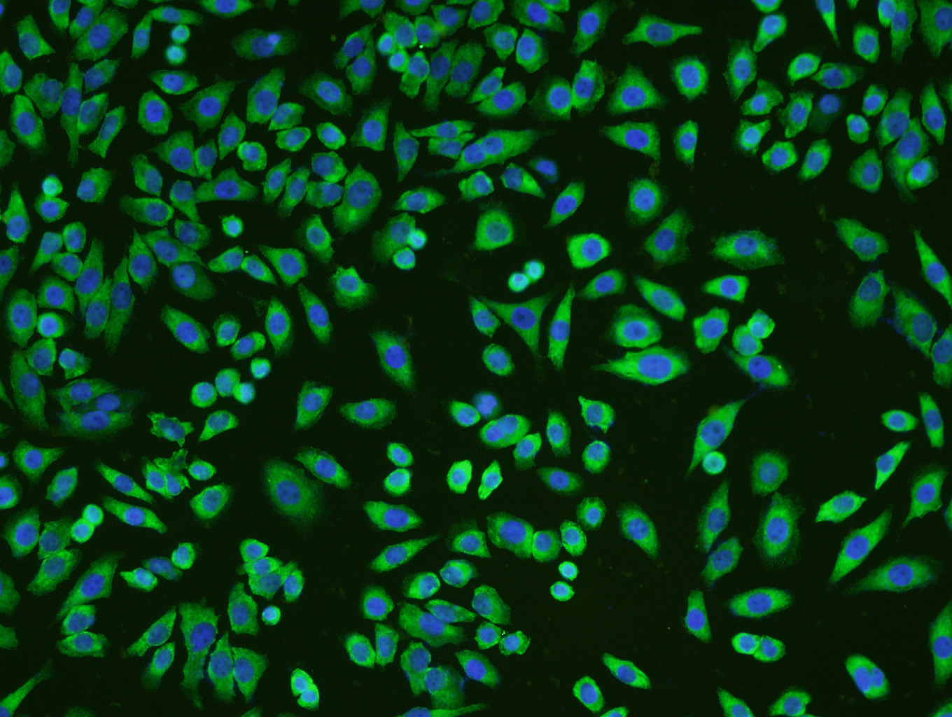 MCF-7 cells were stained with KLF2 Polyclonal Antibody, Unconjugated (bs-2772R) at 1:200 in PBS and incubated for two hours at 37\u00b0C followed by Goat Anti-Rabbit IgG (H+L) FITC conjugated secondary antibody. DAPI staining of the nucleus was done and then detected.