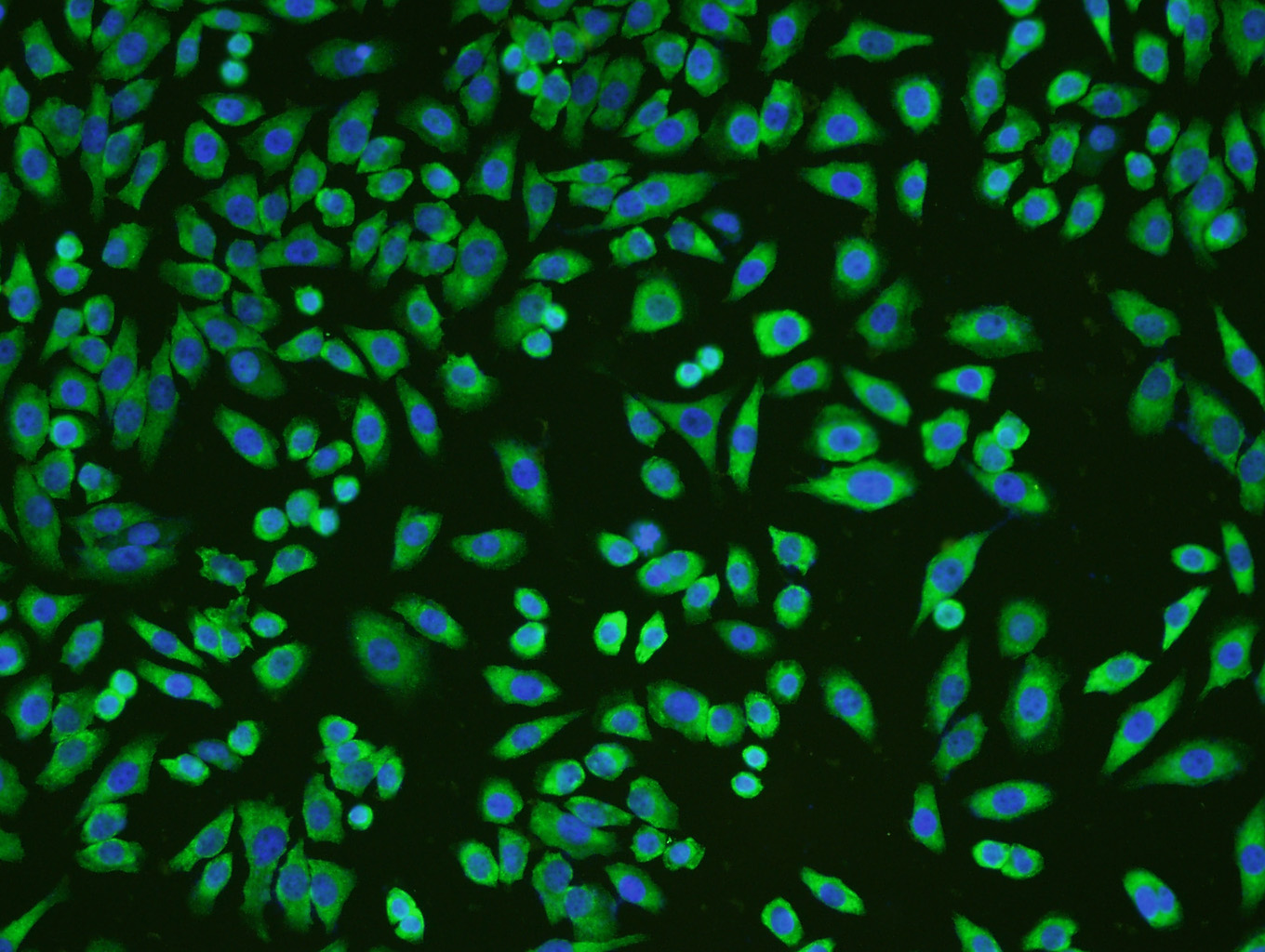 MCF-7 cells were stained with KLF2 Polyclonal Antibody, Unconjugated (bs-2772R) at 1:200 in PBS and incubated for two hours at 37°C followed by Goat Anti-Rabbit IgG (H+L) FITC conjugated secondary antibody. DAPI staining of the nucleus was done and then detected. MCF-7 cells were stained with KLF2 Polyclonal Antibody, Unconjugated (bs-2772R) at 1:200 in PBS and incubated for two hours at 37°C followed by Goat Anti-Rabbit IgG (H+L) FITC conjugated secondary antibody. DAPI staining of the nucleus was done and then detected.