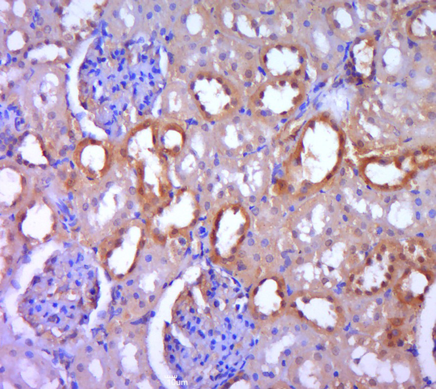 Paraformaldehyde-fixed, paraffin embedded rat kidney; Antigen retrieval by boiling in sodium citrate buffer (pH6.0) for 15min; Block endogenous peroxidase by 3% hydrogen peroxide for 20 minutes; Blocking buffer (normal goat serum) at 37°C for 30min; Antibody incubation with DGKH Polyclonal Antibody, Unconjugated (bs-14298R) at 1:400 overnight at 4°C, followed by a conjugated secondary for 20 minutes and DAB staining.