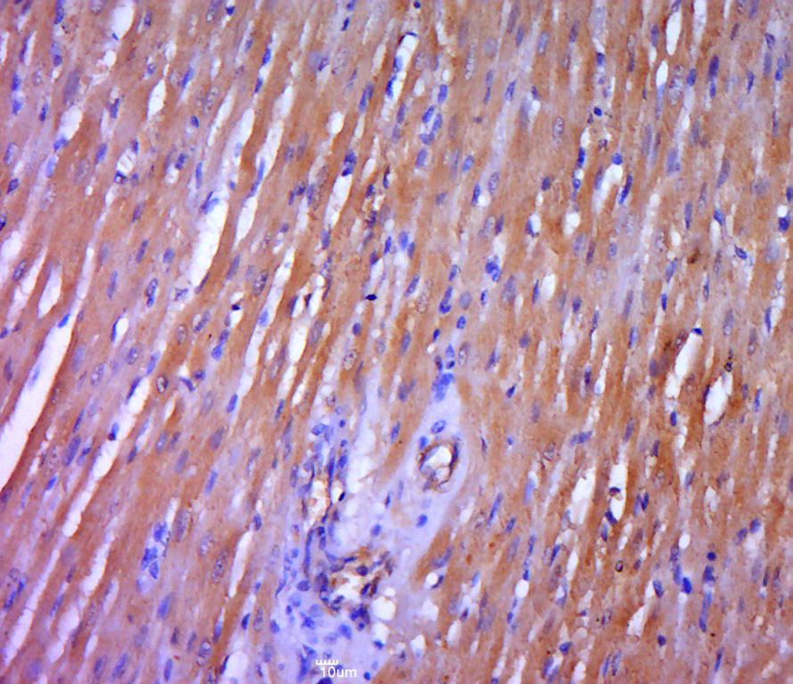 Paraformaldehyde-fixed, paraffin embedded rat heart; Antigen retrieval by boiling in sodium citrate buffer (pH6.0) for 15min; Block endogenous peroxidase by 3% hydrogen peroxide for 20 minutes; Blocking buffer (normal goat serum) at 37°C for 30min; Antibody incubation with DGKH Polyclonal Antibody, Unconjugated (bs-14298R) at 1:400 overnight at 4°C, followed by a conjugated secondary for 20 minutes and DAB staining.