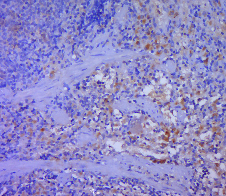 Paraformaldehyde-fixed, paraffin embedded rat spleen; Antigen retrieval by boiling in sodium citrate buffer (pH6.0) for 15min; Block endogenous peroxidase by 3% hydrogen peroxide for 20 minutes; Blocking buffer (normal goat serum) at 37°C for 30min; Antibody incubation with DFNA5 Polyclonal Antibody, Unconjugated (bs-14286R) at 1:400 overnight at 4°C, followed by a conjugated secondary for 20 minutes and DAB staining.