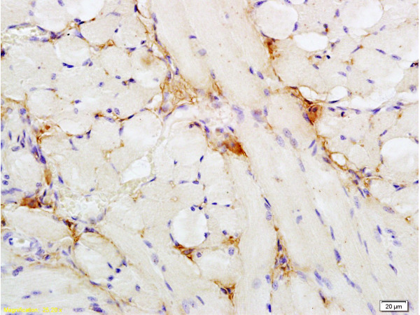 Formalin-fixed and paraffin embedded rat tongue labeled with Anti- Insulin Receptor alpha Polyclonal Antibody, Unconjugated(bs-0047R) 1:200 followed by conjugation to the secondary antibody and DAB staining