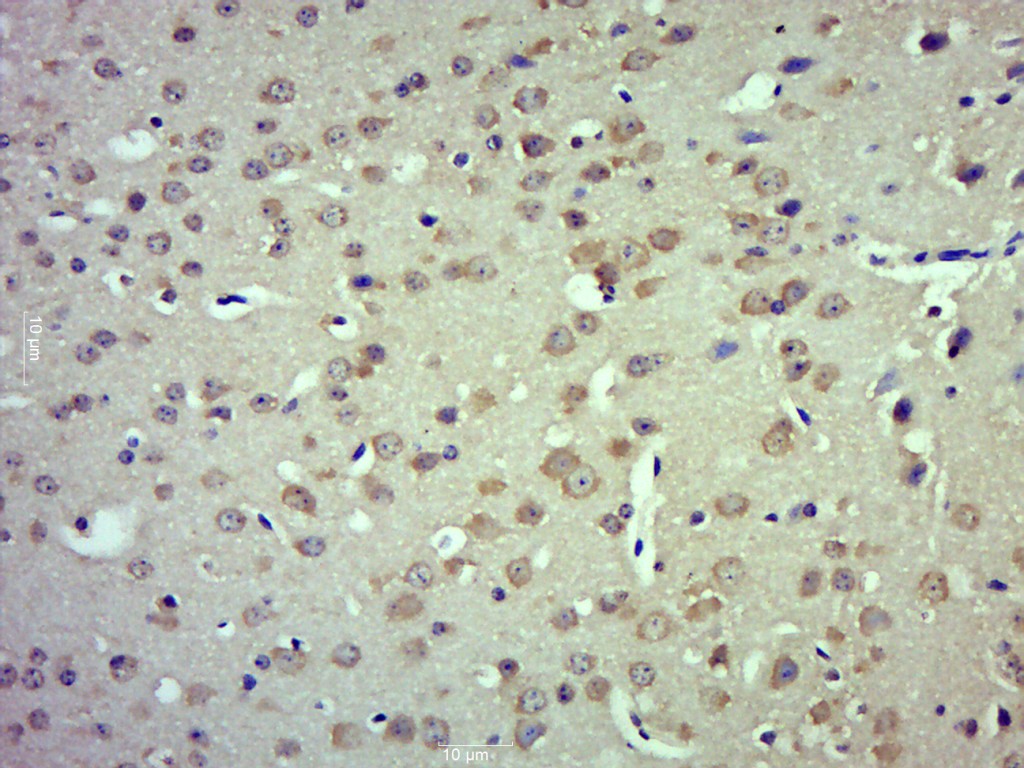 Paraformaldehyde-fixed, paraffin embedded mouse brain; Antigen retrieval by boiling in sodium citrate buffer (pH6.0) for 15min; Block endogenous peroxidase by 3% hydrogen peroxide for 20 minutes; Blocking buffer (normal goat serum) at 37°C for 30min; Antibody incubation with TRPM4 Polyclonal Antibody, Unconjugated (bs-9051R) at 1:500 overnight at 4°C, followed by a conjugated secondary for 20 minutes and DAB staining. _x000D_ _x000D_