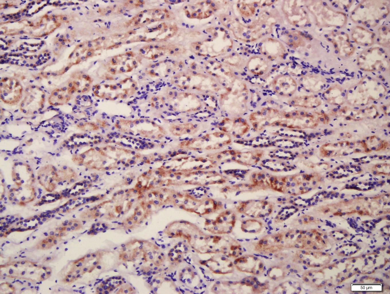Paraformaldehyde-fixed, paraffin embedded Human kidney; Antigen retrieval by boiling in sodium citrate buffer (pH6.0) for 15min; Block endogenous peroxidase by 3% hydrogen peroxide for 20 minutes; Blocking buffer (normal goat serum) at 37°C for 30min; Antibody incubation with CD34 Polyclonal Antibody, Unconjugated (bs-0646R) at 1:400 overnight at 4°C, followed by a conjugated secondary antibody for 20 minutes and DAB staining.