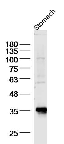 Rat stomach lysates probed with BBS8/TTC8 Polyclonal Antibody, unconjugated (bs-11510R) at 1:300 overnight at 4°C followed by a conjugated secondary antibody for 60 minutes at 37°C.